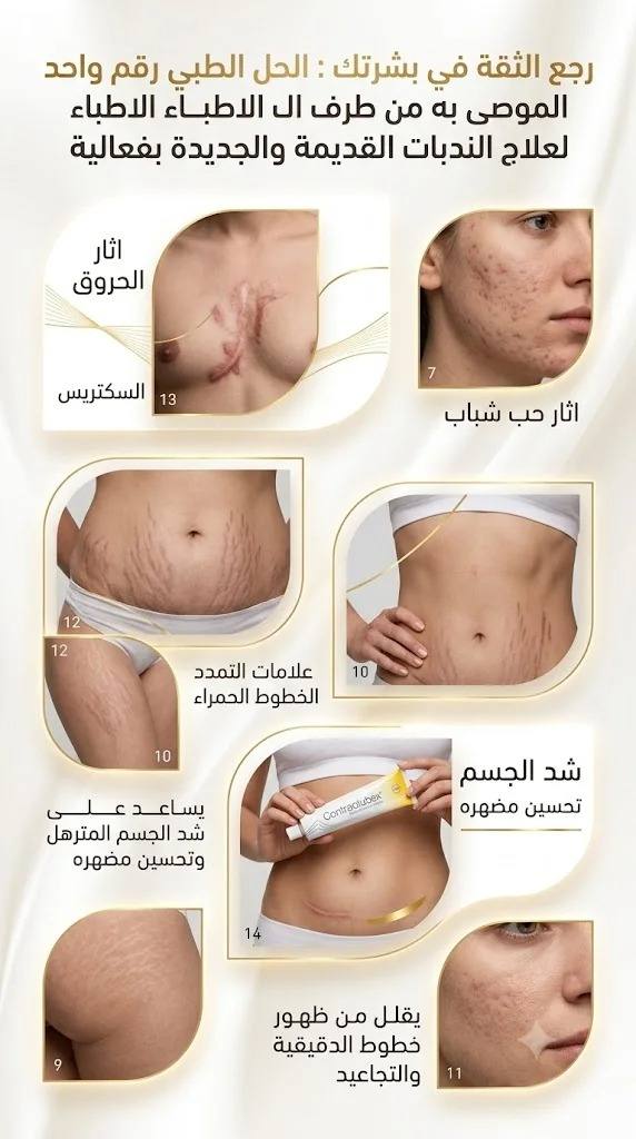 كنتراكتبكس 🔥 غير 200 درهم