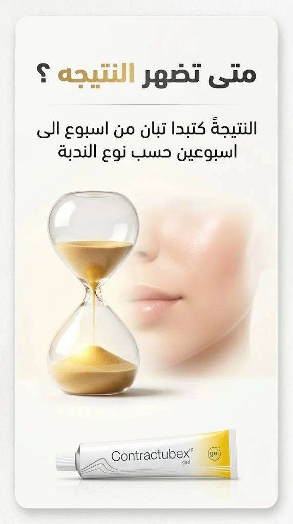 كنتراكتبكس 🔥 غير 200 درهم
